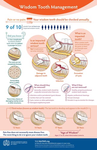 wisdom_teeth_management_infographic-tile